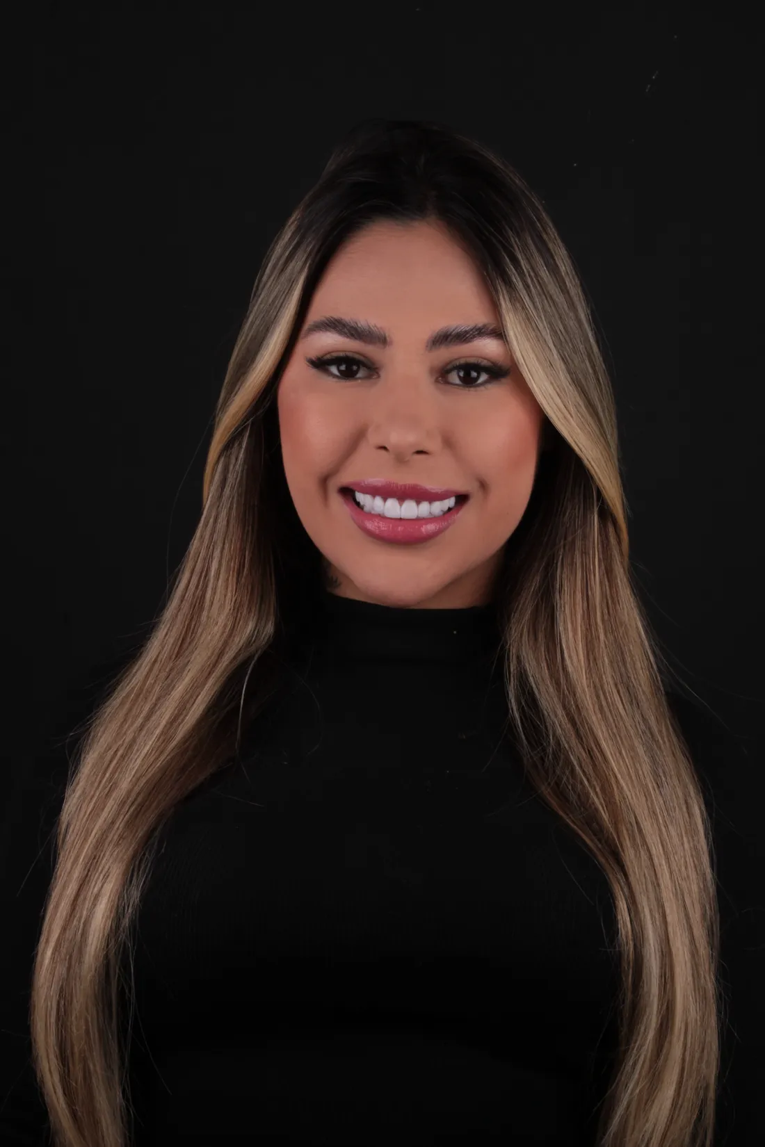 O que faz o preço da lente de contato dental variar tanto